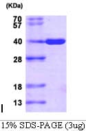 Human DDX / AKR1C3 Protein (Recombinant His)