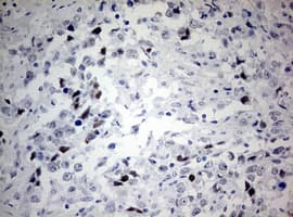 p16INK4a / CDKN2A Antibody (aa25-156, clone OTI1F6)
