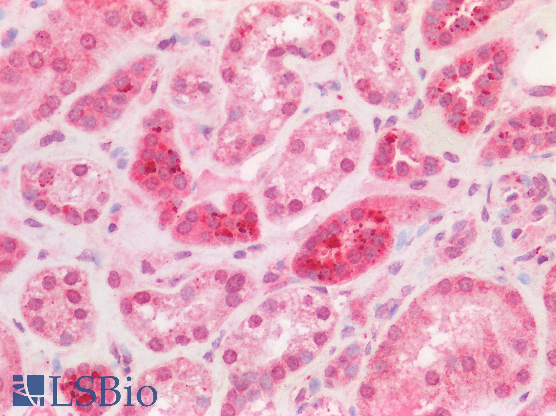 PPT1 / CLN1 Antibody (C-Terminus)