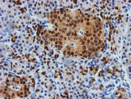 FBXO21 Antibody (clone OTI5H4)