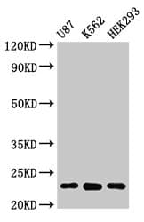 Polyclonal Rabbit anti-Human HIST1H1B Antibody (IHC, IF, WB)