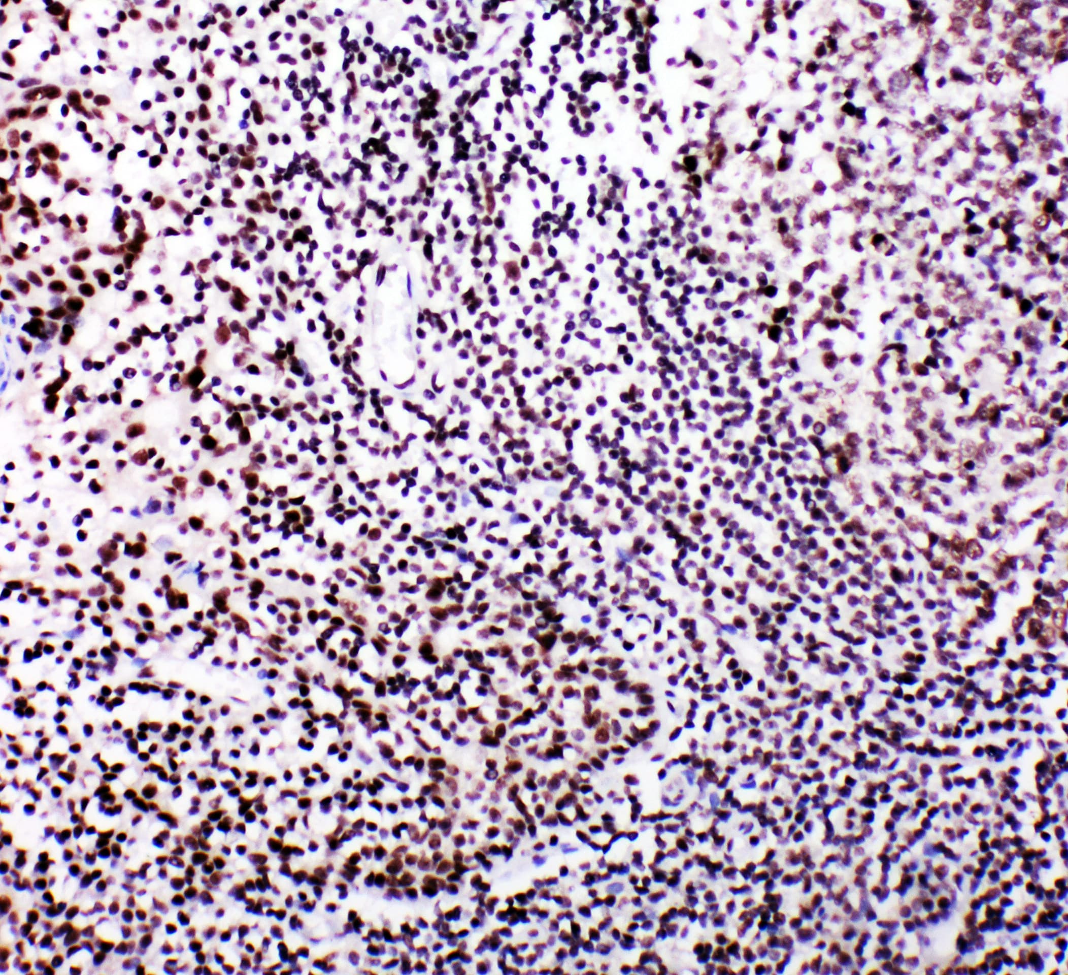 MYBL2 Antibody (aa1-17)