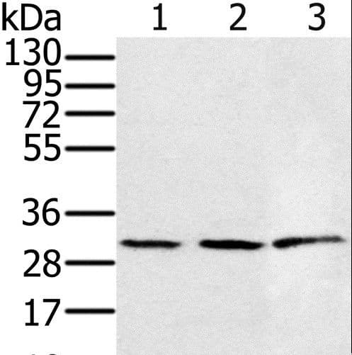IHC-plus™ HSD17B8 / RING2 Antibody