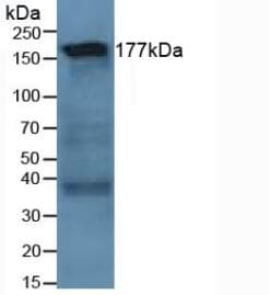 LAMC1 / Laminin Gamma 1 Antibody (aa521-772, PE)