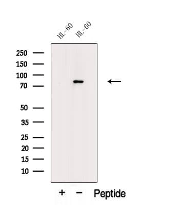 MPO / Myeloperoxidase Antibody