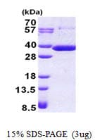 Human RARRES1 Protein (Recombinant His)