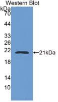 CAP2 Antibody