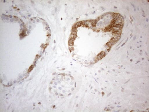 BCL2 / Bcl-2 Antibody (clone UMAB225)