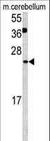 Polyclonal Rabbit anti-Human GLRX2 / Glutaredoxin 2 Antibody (aa120-146, IHC, WB)
