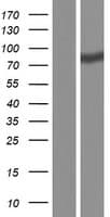 Human MAP7D2 Protein (Over-Expression Lysate Myc-DDK (Flag))