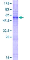 Human ZDHHC3 Protein (Recombinant GST)