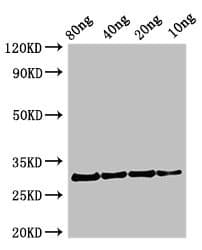 PFN1 / Profilin 1 Antibody
