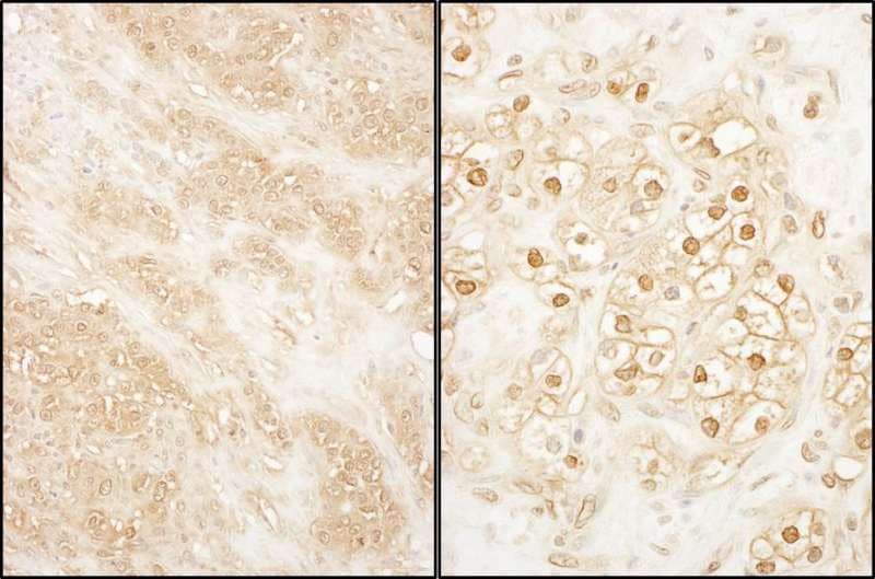 CDK17 / PCTK2 / PCTAIRE2 Antibody (aa1-50)