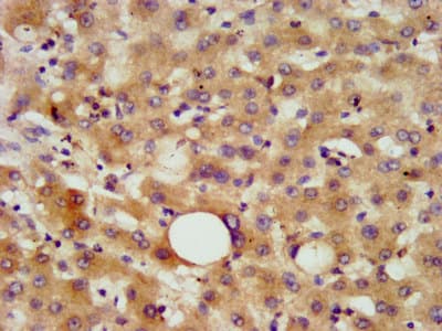 CHN2 / Chimerin 2 Antibody