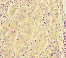 Polyclonal Rabbit anti-Human SRRM2 Antibody (IHC)