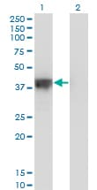 DFFA / ICAD / DFF45 Antibody (clone 3A11)