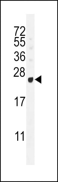 GAGE12B Antibody (aa21-49)