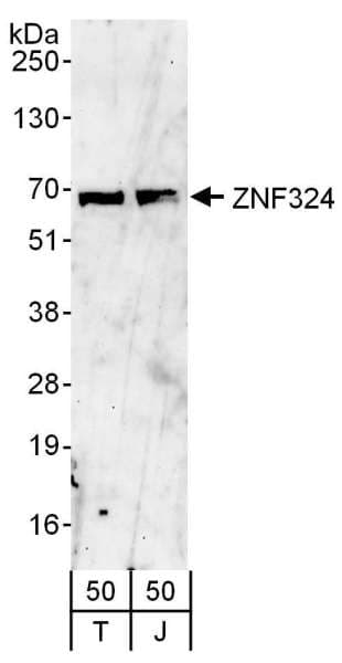ZNF324 / ZF5128 Antibody (aa503-553)