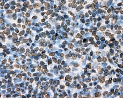 Monoclonal Mouse anti-Human Basigin / Emmprin / CD147 Antibody (clone OTI4E11, IHC, IF, WB)