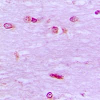 Polyclonal Rabbit anti-Human BRF1 Antibody (Internal, IHC, IF, WB)