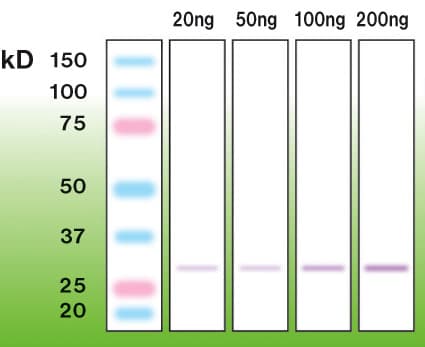 C1QTNF5 / CTRP5 Antibody (N-Terminus)