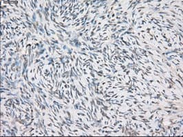 FCGR2 / CD32 Antibody (clone OTI19C10)