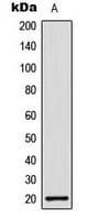 H1F0 Antibody (Internal)