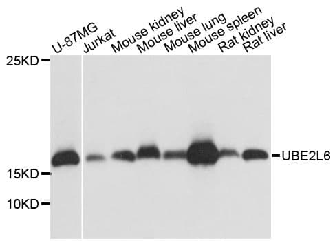 Polyclonal Rabbit anti-Human UBE2L6 Antibody (WB)