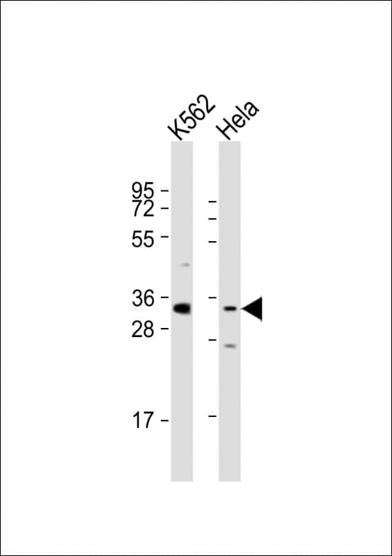PRSS21 / Testisin Antibody (aa14-26)