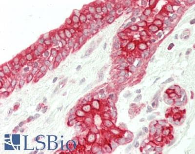 IHC-plus™ KRT10 / CK10 / Cytokeratin 10 Antibody (aa1-584)