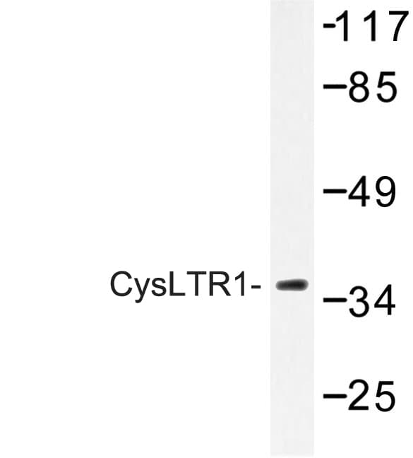 CYSLTR1 / CYSLT1 Antibody (Lys172)