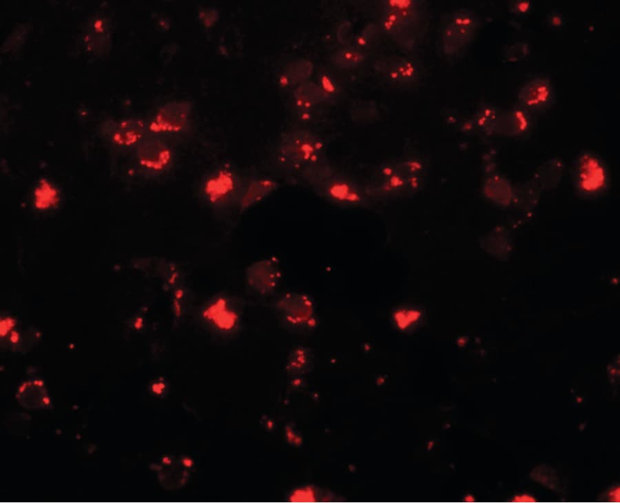 IHC-plus™ Polyclonal Rabbit anti-Human SH3RF2 Antibody (IHC, IF, WB)