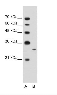 MAP3K7CL / TAK1L Antibody (aa151-200)