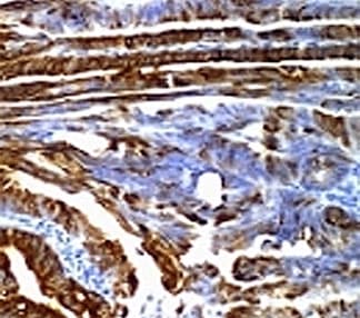 Mucin 2 / MUC2 Antibody (clone SPM296)