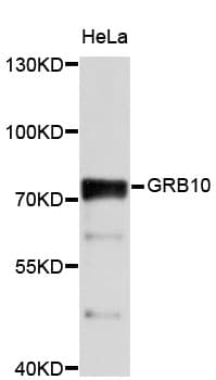 Polyclonal Rabbit anti-Human GRB10 Antibody (WB)