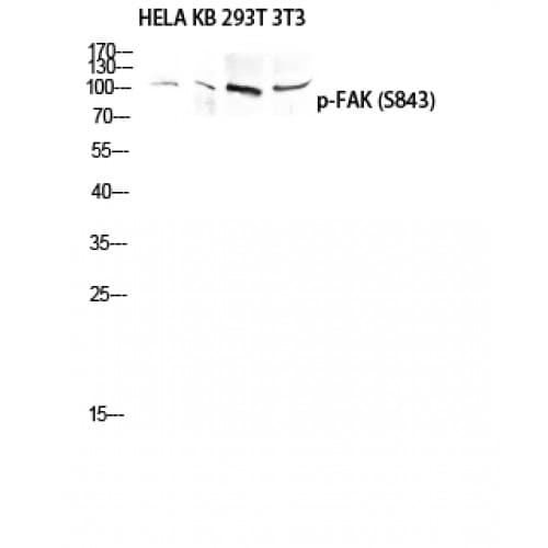 FAK / Focal Adhesion Kinase Antibody (780-860 aa)