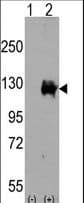TRPM8 Antibody (aa1075-1104)