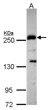 Polyclonal Rabbit anti-Human PLXND1 / Plexin D1 Antibody (aa1633-1724, WB)