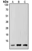 SUMO2 Antibody (Internal)