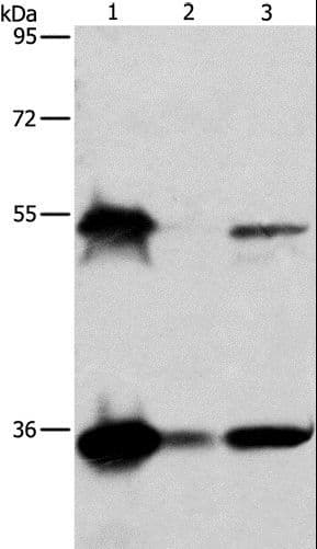 BAG1 / BAG-1 Antibody