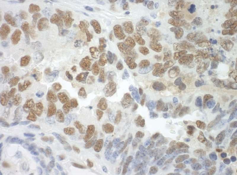 SF3A3 / SF3a60 Antibody (aa451-501)