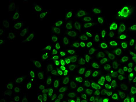 SMARCA4 / BRG1 Antibody