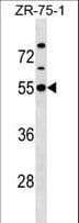 KCNJ1 / ROMK Antibody (aa345-374)