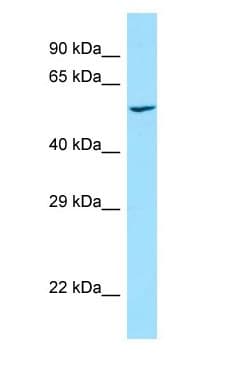 PRKCSH Antibody (aa89-138)