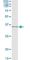 Monoclonal Mouse anti-Human IL-1B / IL-1 Beta Antibody (clone 2A8, IF, WB)