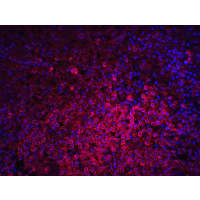 Polyclonal Rabbit anti-Human LY96 / MD2 / MD-2 Antibody (IHC, IF, WB)
