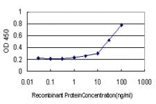 MTM1 / Myotubularin Antibody (clone 1C10)