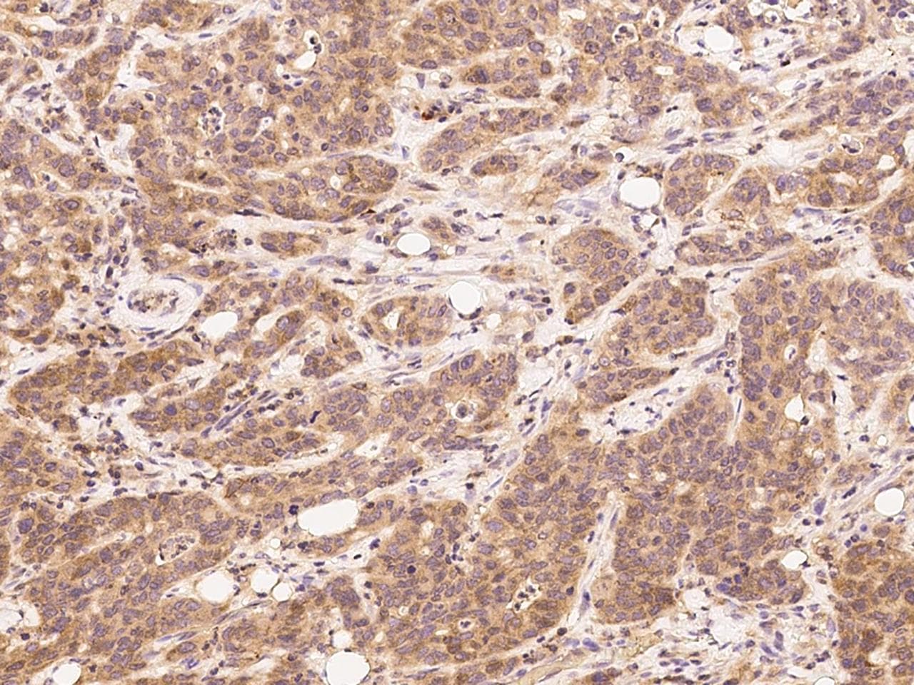 HAO1 Antibody (Preservative Free)