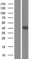 Human SLC30A2 Protein (Over-Expression Lysate Myc-DDK (Flag))