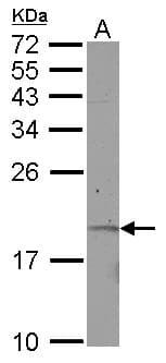 Polyclonal Rabbit anti-Human KRTAP11-1 Antibody (WB)